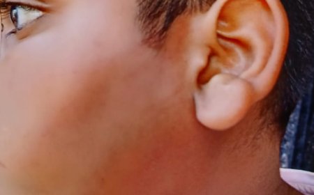 Breaking: A minor from Koli community became a victim of Jamnagar police's hooliganism